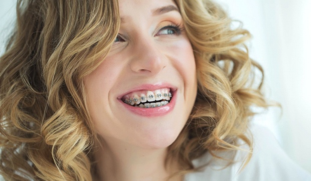 A young woman wearing braces